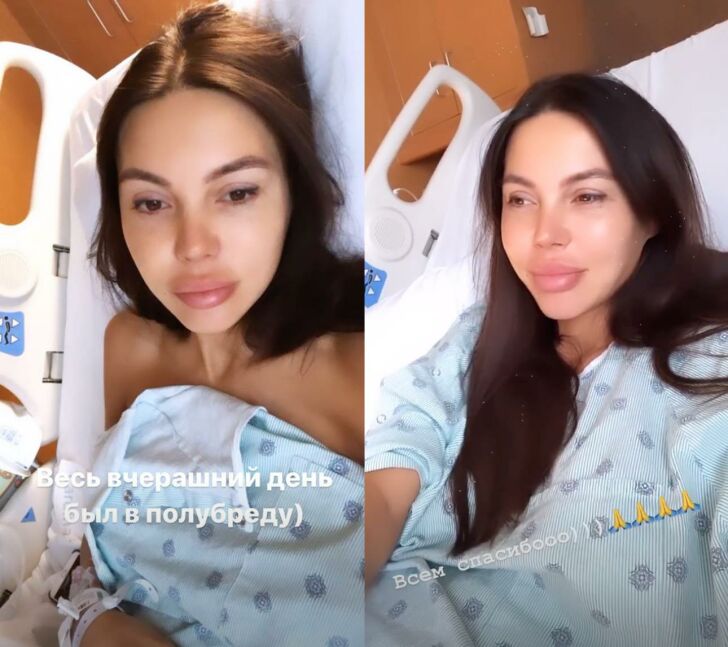 Оксана самойлова до операции и после фото