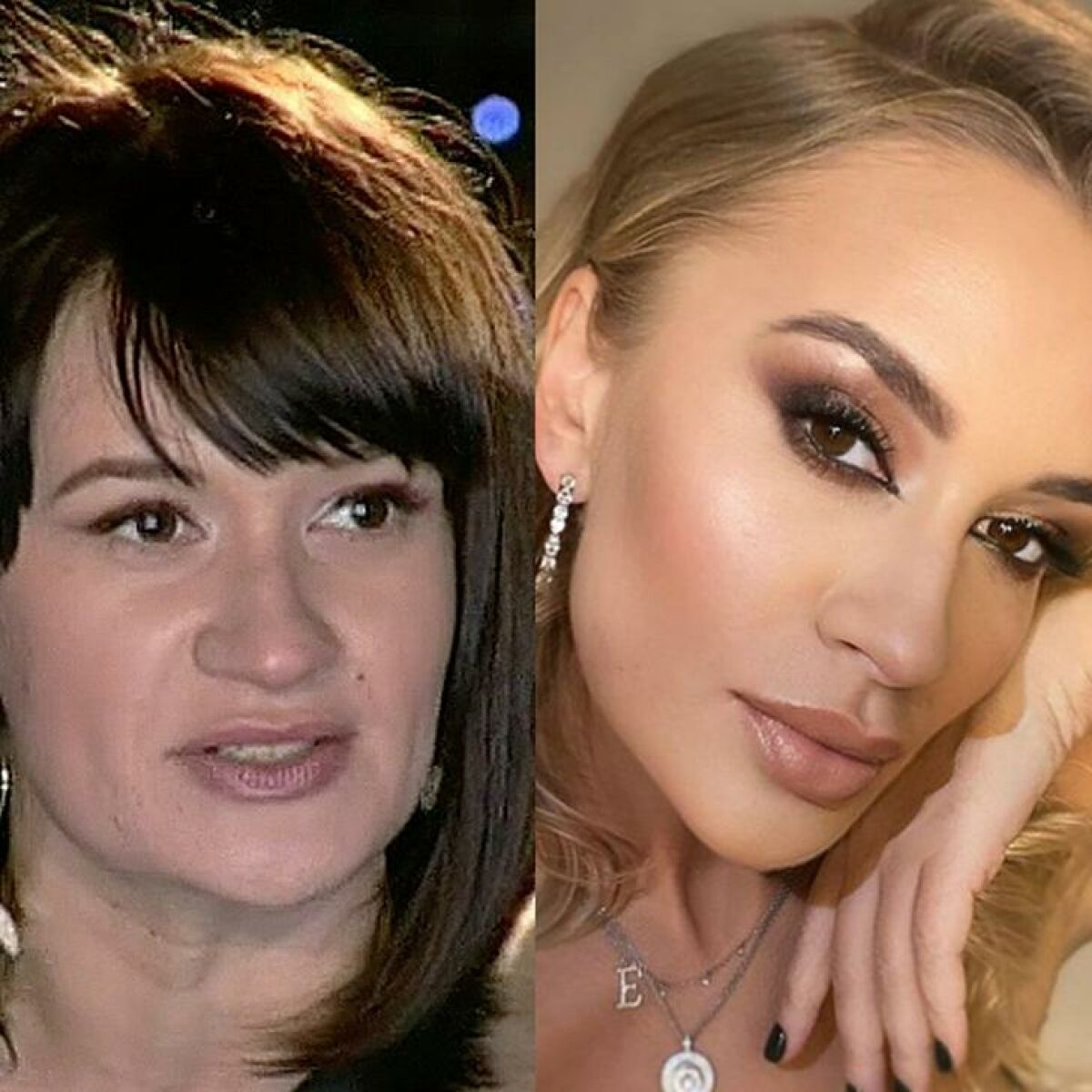 Елена Бушина фото до и после пластики